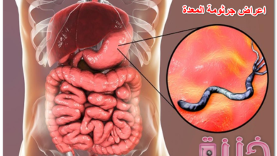 اعراض جرثومة المعدة