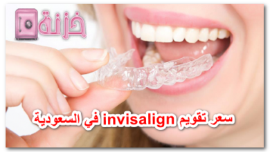 سعر تقويم invisalign في السعودية